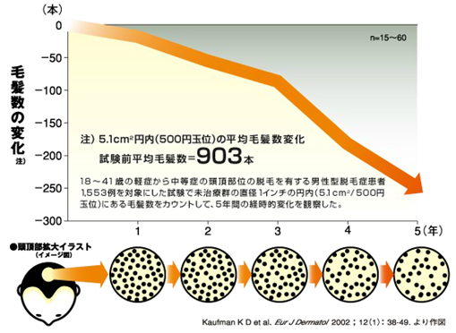 AGAの5年間の毛髪数の変化