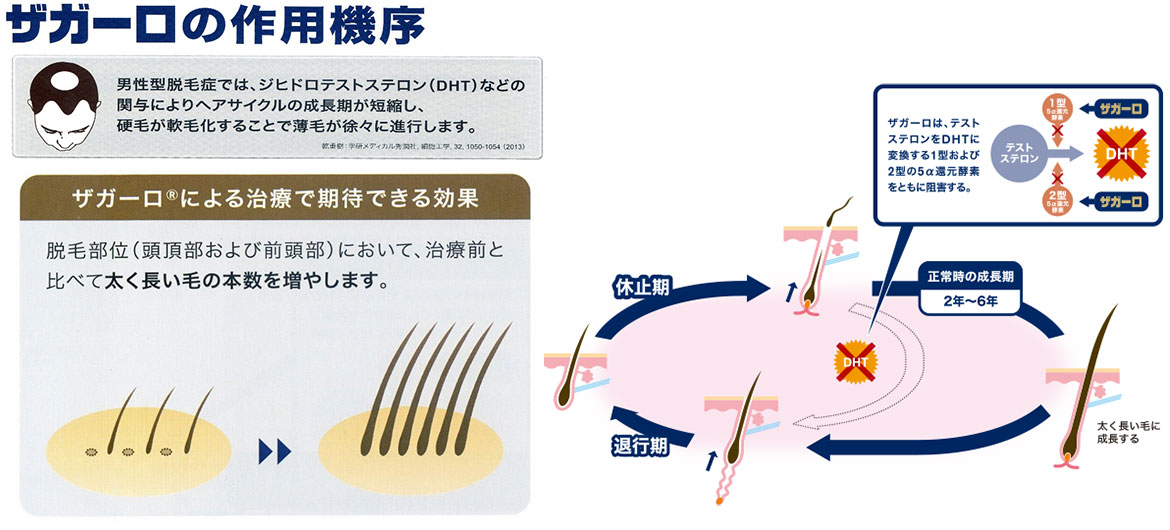 ザガーロの作用機序